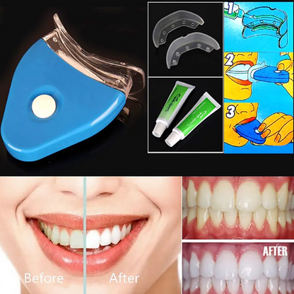 Clareamento dental com LED
