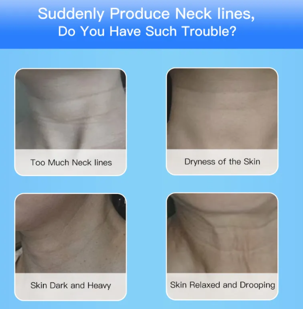 Instrumento de lifting facial - Para firmar a pele e reduzir o queixo duplo